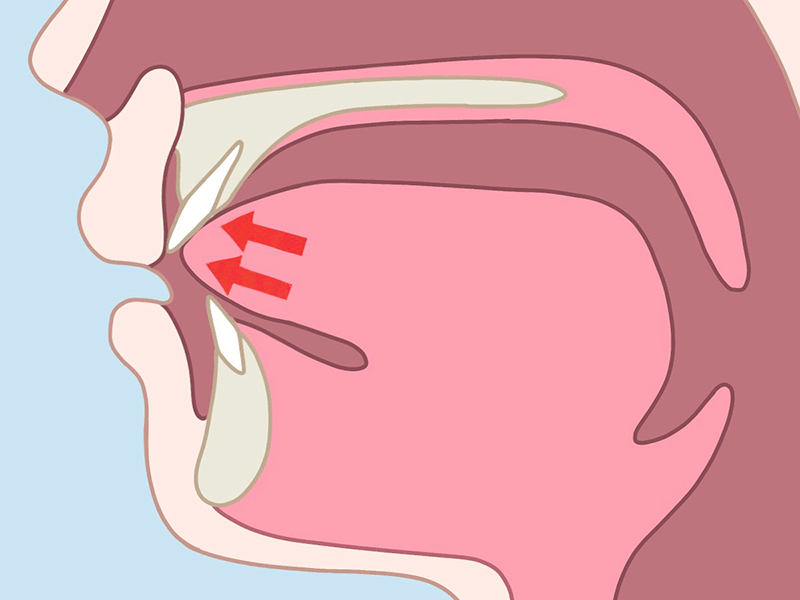 悪習癖がある場合