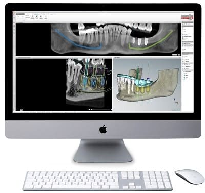 3Dコンピューターシミュレーション