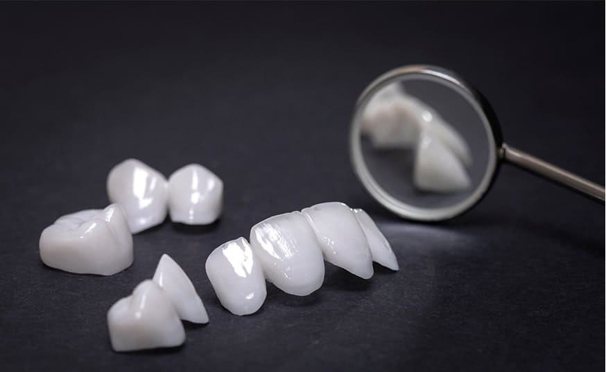 セラミック審美治療