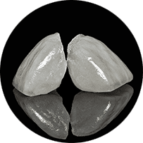 審美セラミック歯科治療