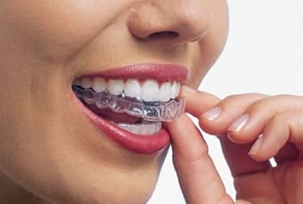 取り外しができて衛生的