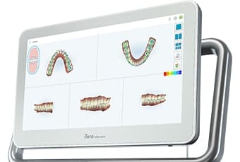 iTero スキャニング