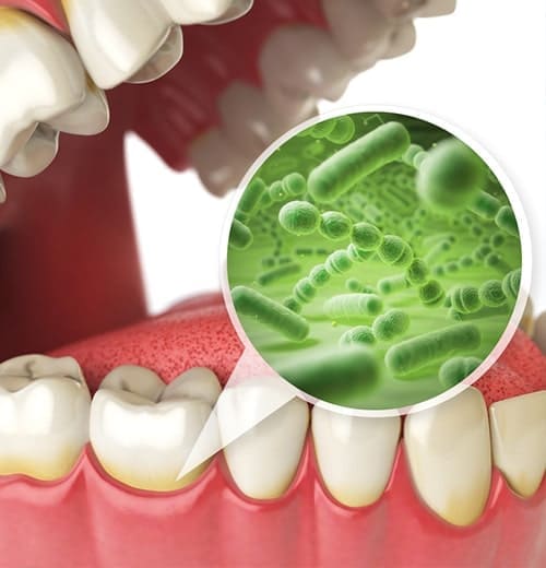 なるべく歯を削らず、痛みのない丁寧な虫歯治療を