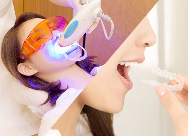 デュアルホワイトニング